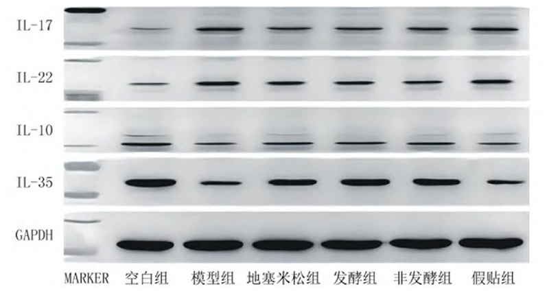 空白組和支氣管哮喘各組大鼠肺組織中IL－17、IL－22、IL－10、IL－35蛋白表達(dá)電泳圖